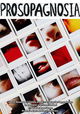 Prosopagnosia