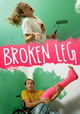 Broken Leg