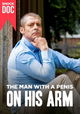 The Man with a Penis on His Arm