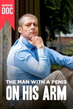 The Man with a Penis on His Arm (2022)