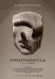Prosopagnosia