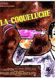 La coqueluche