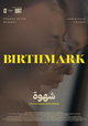 Birthmark