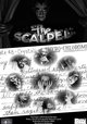 The Scalpel