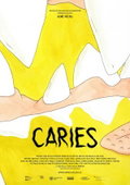 Caries (2025)