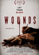Wounds