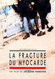 La fracture du myocarde