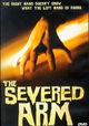 The Severed Arm