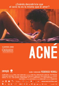 Acné (2008)