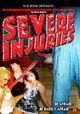 Severe Injuries