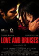 Love and Bruises