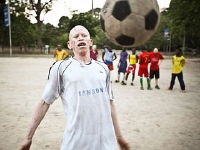 Albino United (2010)