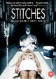 Stitches