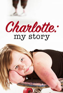 Charlotte: A Life without Limbs (2014)
