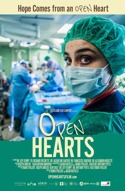 Open Hearts