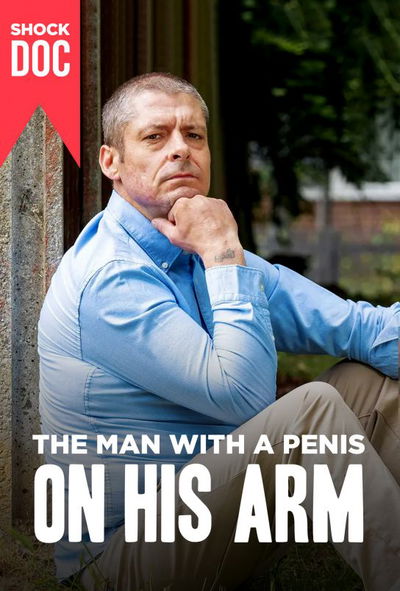 The Man with a Penis on His Arm