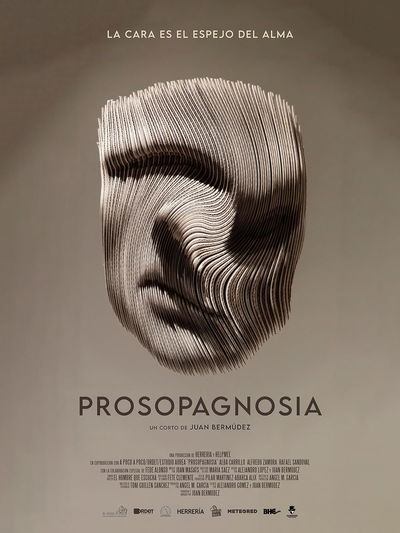 Prosopagnosia