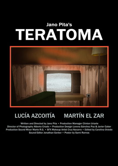 Teratoma